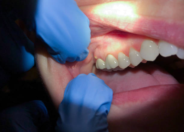 Best Emergency Treatment for Toothache in Greenfield, IL